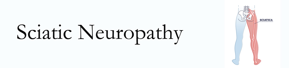 Largo neuropathy pain (sciatica) 